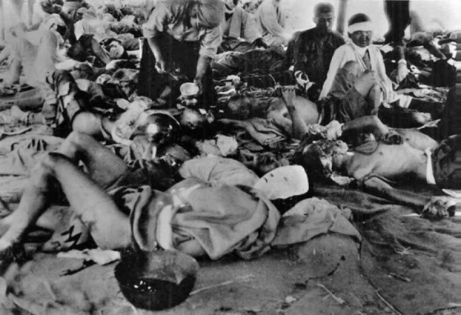 Жертвы атомного взрыва, которые находятся в палаточном центре помощи 2-го военного госпиталя Хиросимы