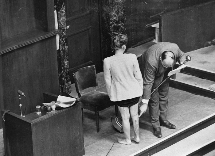 Демонстрация телесных повреждений бывшей узницы концлагеря Равенсбрюк на Нюрнбергском процессе. Польская женщина была подвергнута экспериментам по пересадке кости ноги